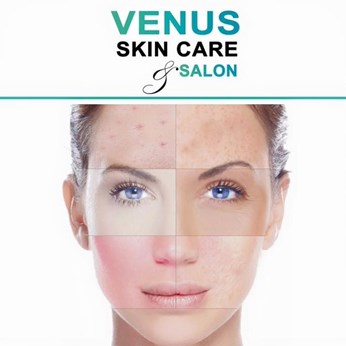 Venus Skin Care & Holistic Care
