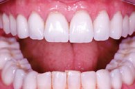 Downtown Dental Center in Atlanta, GA