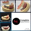 Center For Implant Dentistry in San Francisco, CA