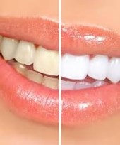 Special Smiles General Dentistry