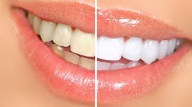 Dental Associates Esko