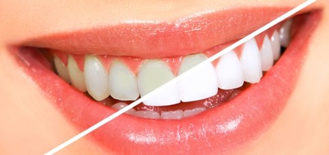 Lucke Dental