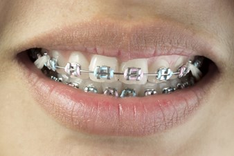 Sugar Creek Smile Dentistry - Doctors in Sugar Land, TX in Sugar Land, Sugar Land