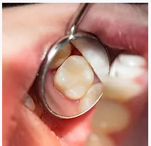 Artisan Smiles Dental -  Dr. Preethi Bangalore
