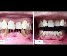 Sonia Tailor Dentist
