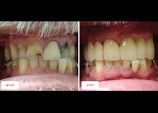 Sonia Tailor Dentist