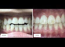 Sonia Tailor Dentist