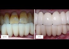 Sonia Tailor Dentist